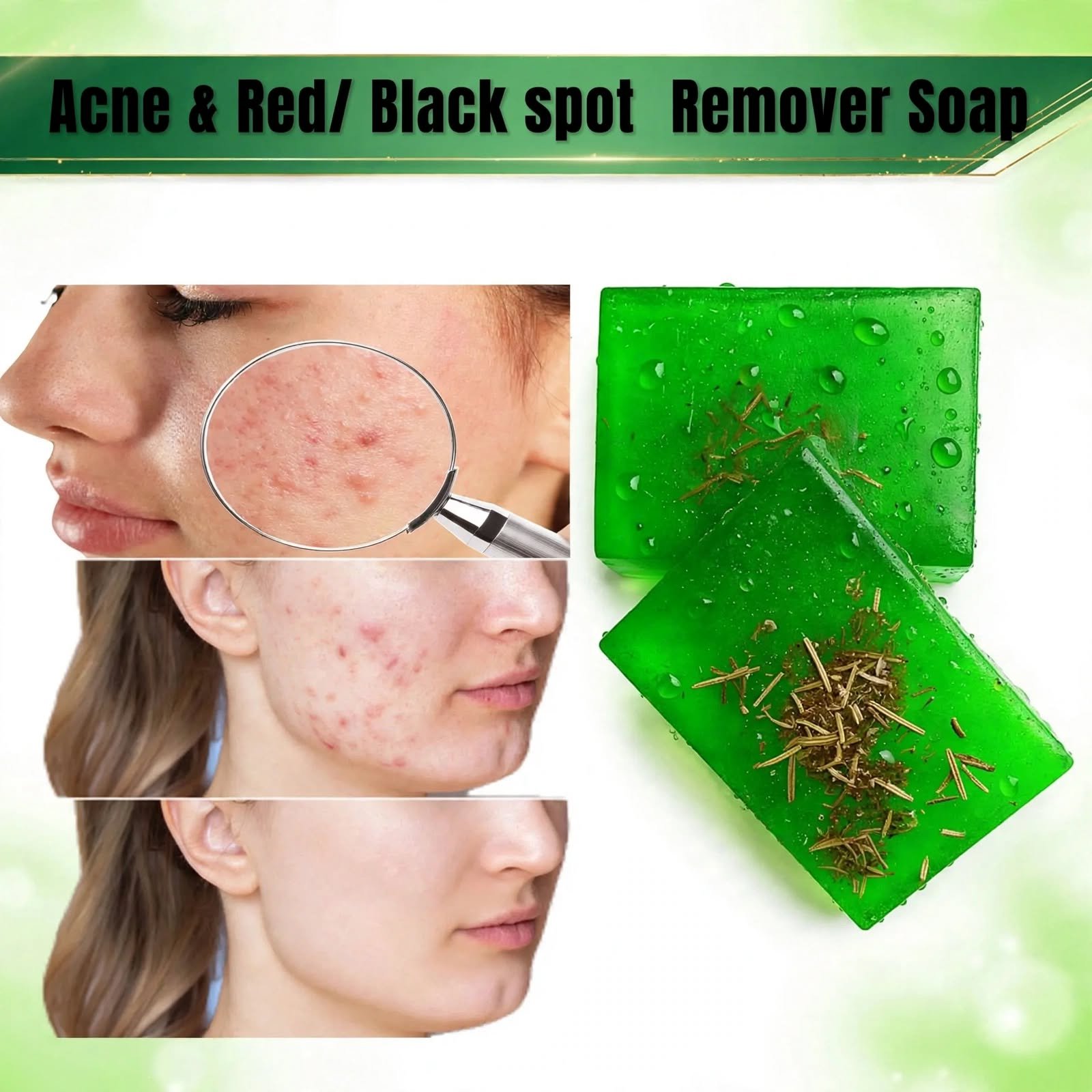 Acne Spot Remover Soap - Image 2
