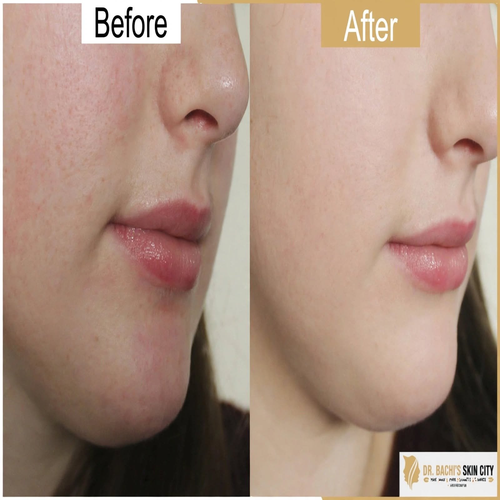 Whitening Soap - Image 3